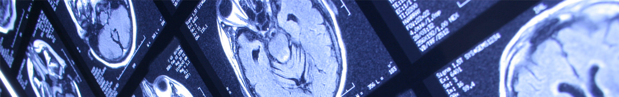 radiology brain scan